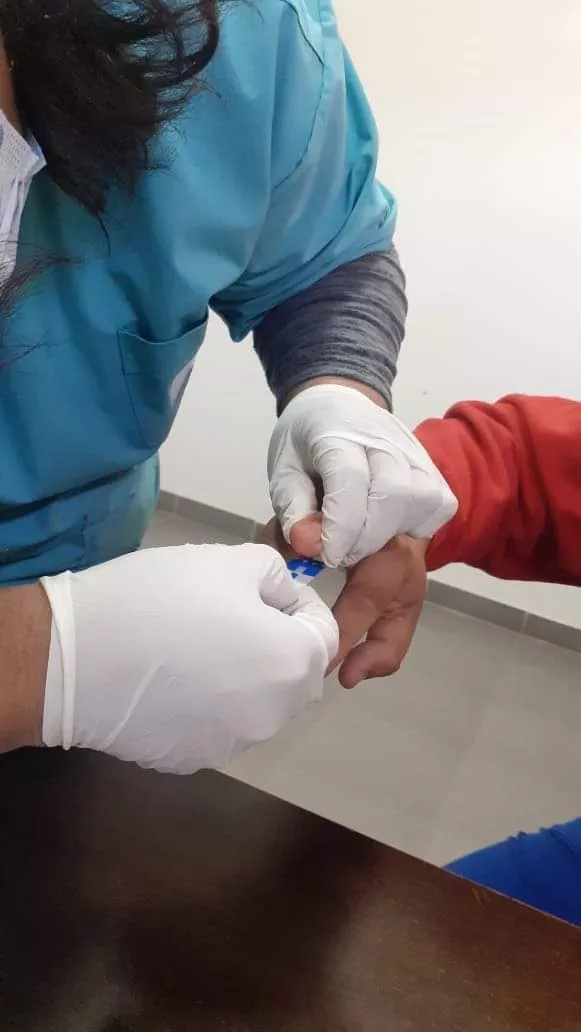 test HIV